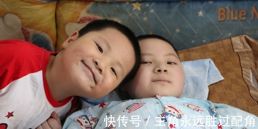 现实版|患难兄弟!身患怪病的兄弟俩骨折近百次,成现实版“瓷娃娃”