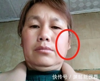 衰老期|女人进入衰老期,身上会有3处开始“变大”,中了一样也得承认