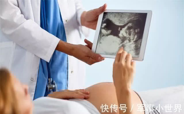 酸杏|胎宝出生后性别“反转”,原因其实很简单,夫妻别在孕期做傻事