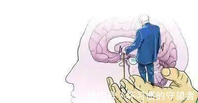 影像学|小脑萎缩症状的中医治疗原则