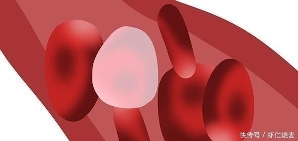 腰围|找到了甘油三酯升高的原因了!教你如何降甘油三酯