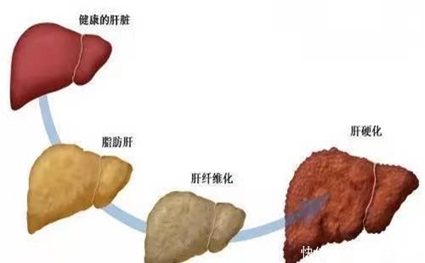 现了问题|养肝就是养命,肝不好会有4点表现,如果没有说明肝是健康的