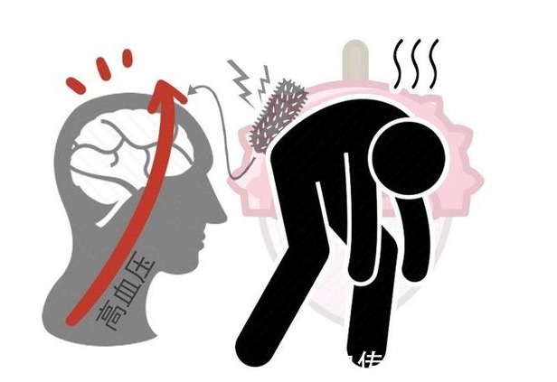 动脉血栓|好端端的,为何血栓专找这4类人?建议:做好2点,可疏通血管