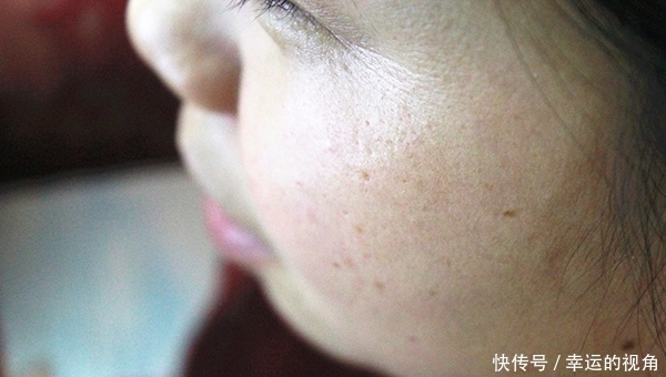 35岁女子,每天吃一颗维生素E,会怎么样?维生素E能抗衰老吗?