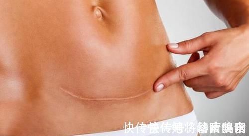 产妇|产检时,医生会问“头胎还是二胎”,这里面的小九九可要知道