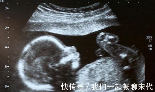 宝宝|胎儿大脑有3次发育“高峰”,孕妈2种营养不能少,宝宝出生更聪明