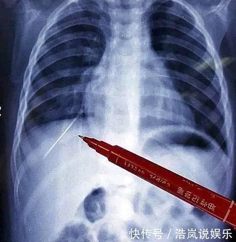 老师|6岁女童胸口不让人碰,有天学校体检,老师让父母道歉