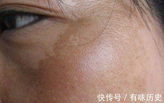 皮肤|邻居大妈只因每天睡前抹了一种小粉末,两周祛斑,皮肤白过卫生纸