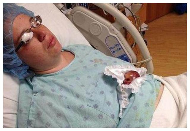 睡眠时间|14年前的“巴掌女婴”,出生只有半斤重,现在怎么样了?