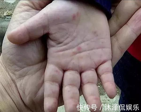 武汉儿童医院|一个针眼大的东西每年都在夺走宝宝的命宝妈们，你还在无所谓