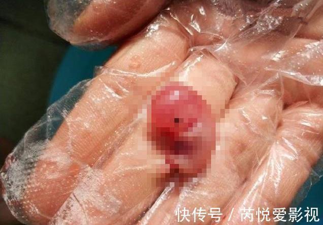 宝妈|60天胎儿流产出来的模样,撼动人的心弦,网友:我都不忍心看