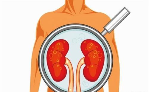 乳酸性酸中毒|糖尿病天天吃二甲双胍，请花几分钟时间搞清这5个问题，很重要