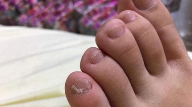 脚趾|长寿的人脚上往往有以下4个“表现”,若你也有,那恭喜了!