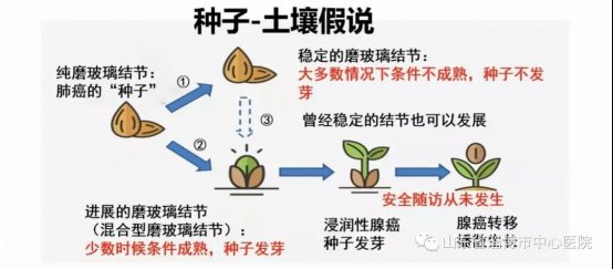 淄博市中心医院|医学科普｜淄博市中心医院：说说肺磨玻璃结节的那些事