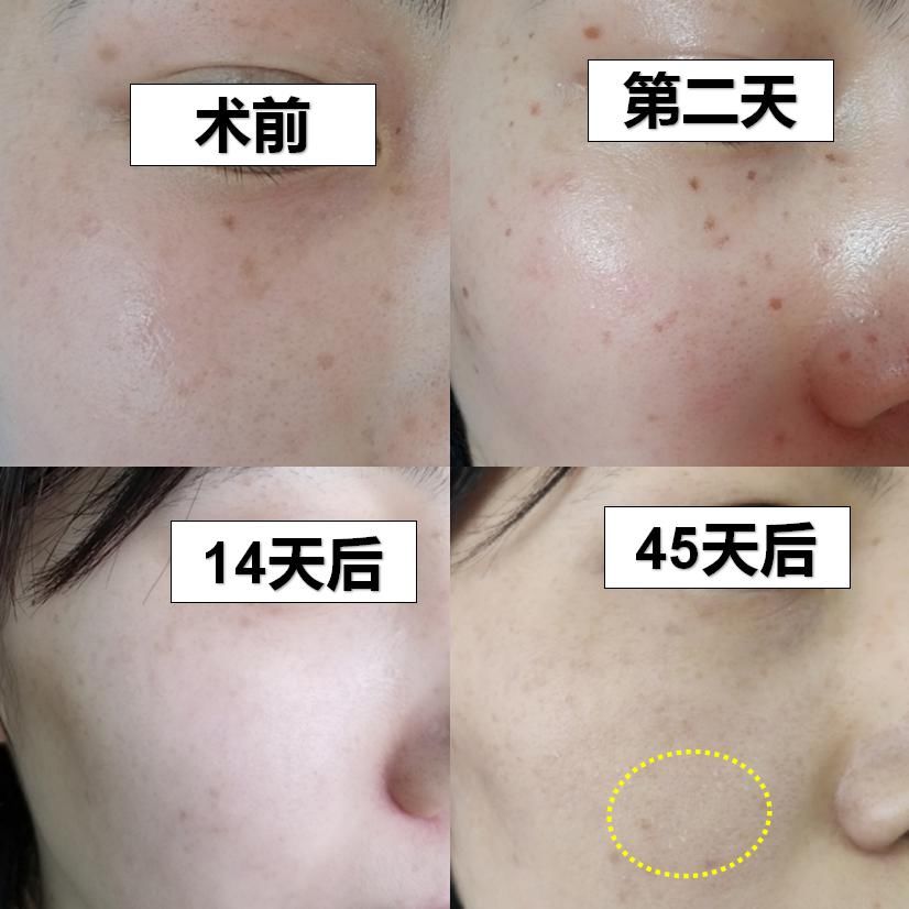 美到甘愿被她抢老公，王思聪新盯上的女友到底赢在哪？