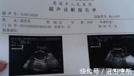 胎动|怀孕后的这3个“表现”,可能暗示了胎儿性别的“小秘密”!