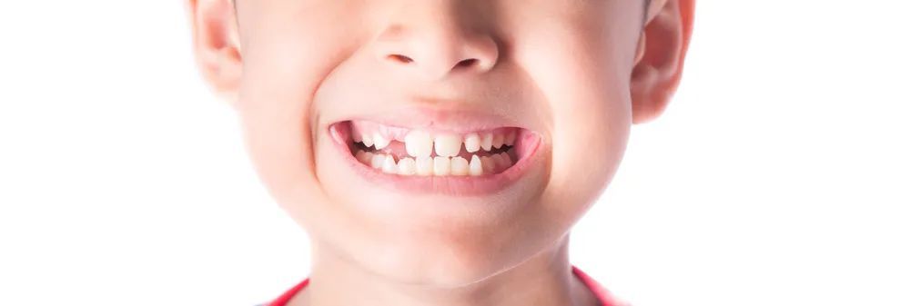牙齿|牙齿健康要从小抓起！6个小贴士帮助宝宝牙齿健康