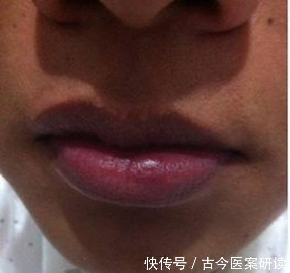 医生|肺病来临,身体会出现这5个异常,医生:坚持2件事,提高肺功能