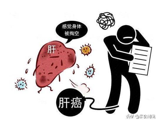 症状|体内有癌,肚子第一个发声?这2种异常表现,是肝脏癌变信号?