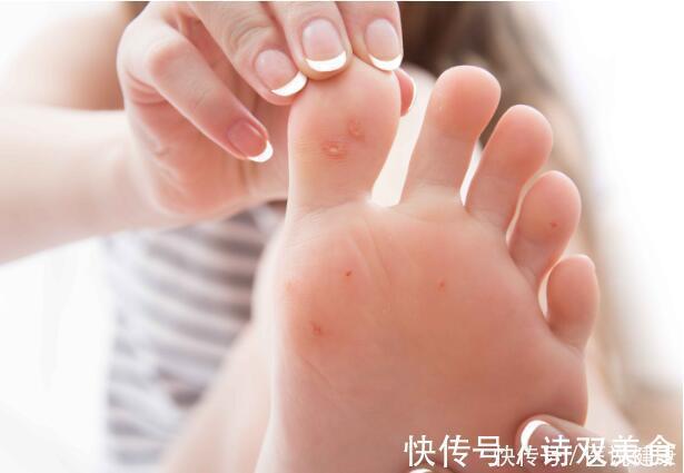 脑血栓|糖尿病不可怕,但血糖一旦失控,诱发的4种并发症很“要命”!