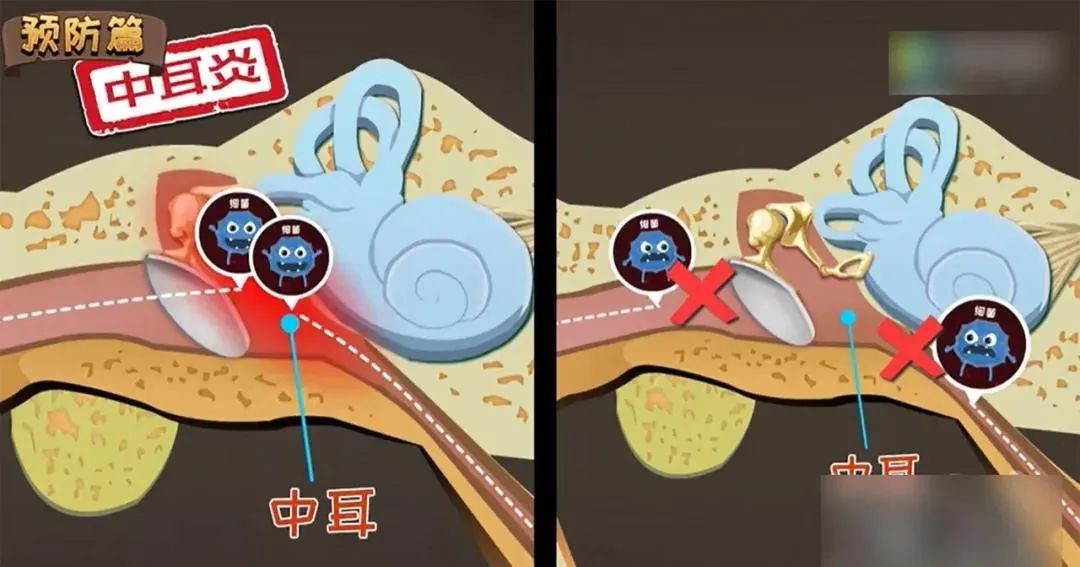 养育|【科学养育】2岁孩子总是抓头，险酿大祸！医生：幸亏来得早！