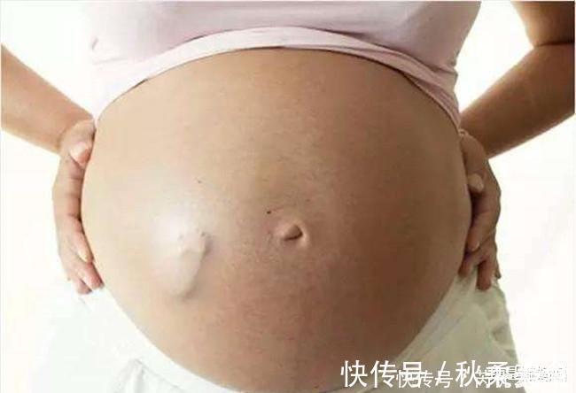 侧切|同样是“一刀”,侧切和剖腹产区别有多大?这7大区别你未必想得到