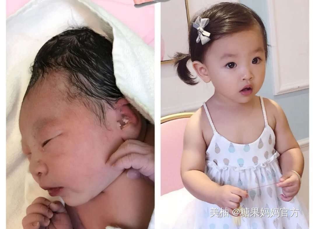 逆袭|新生儿这几个部位丑，反而预示高颜值，宝宝逆袭的我你高攀不起