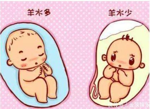 宝宝们|孕期,若孕妇身体出现这3种“症状”,可能是羊水过少,别忽视