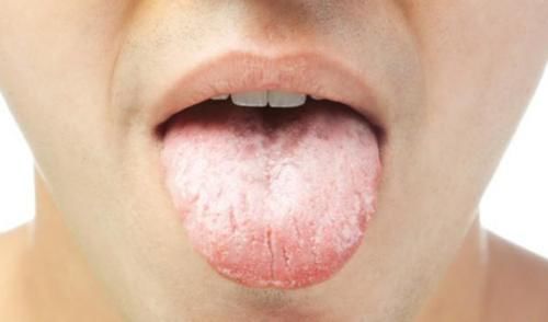 湿气重的人，尽量少吃这5种水果，不妨了解了解