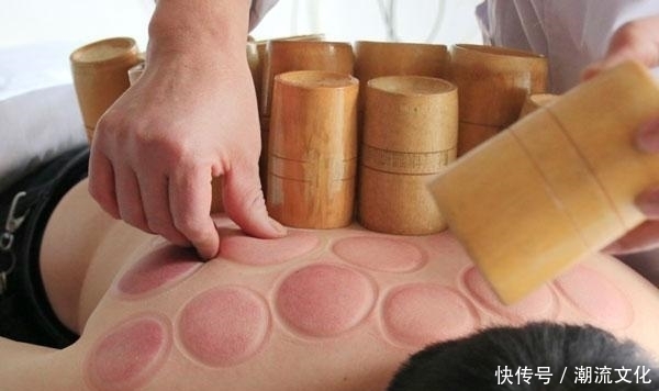 拔罐能排毒吗？拔罐时，红印越深说明什么？