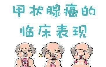 甲状腺结节出现以下一个危险因素即可诊断为甲状腺癌
