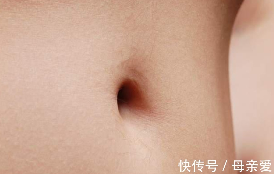 肚脐眼|肚脐眼里的“泥”到底是什么,抠了肚子会漏气?听听医生咋说
