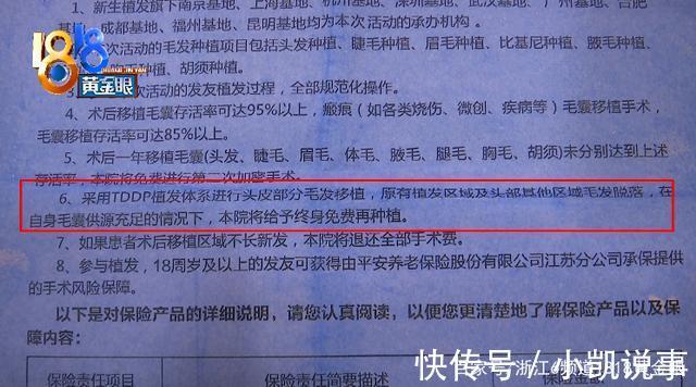 植发 植发两年急转直下 质疑“拆东墙补西墙”
