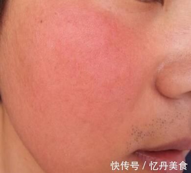 身体|高血压会引起身体出现这些表现, 当你发现时别忽视!