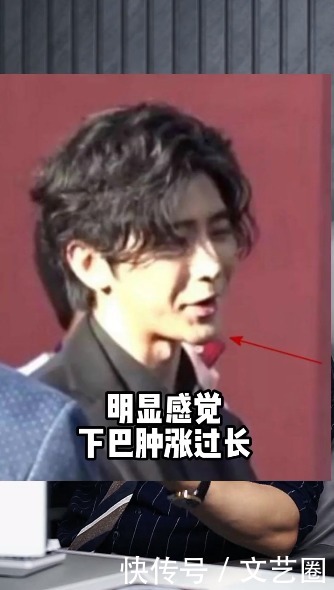 蔡徐坤被质疑整容,男网红回应:他只动了牙齿和下巴,其它地方没喷的