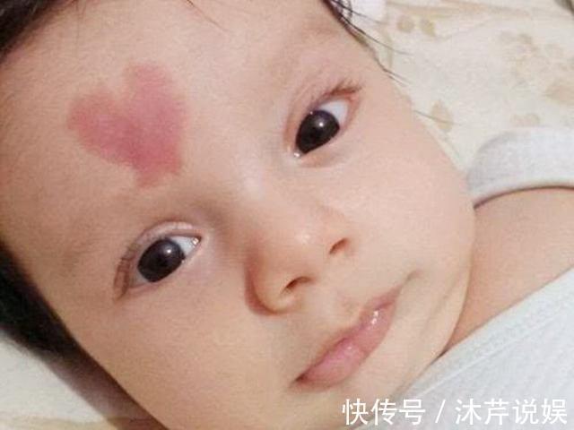 孕妈|产科专家要想宝宝不长胎记,孕期避开三件事就OK,别不当回事