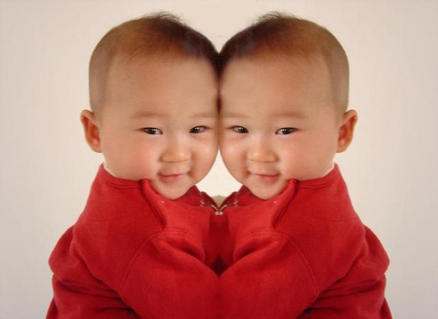 医生|两年备孕怀上双胞胎，B超结果是连体婴儿，坚持下来后意外惊喜！