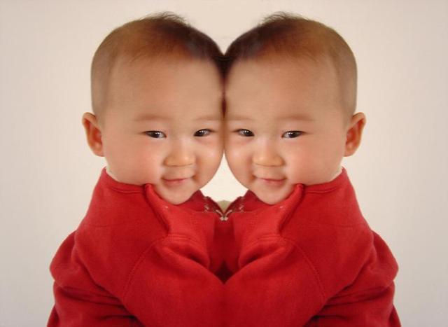 医生|两年备孕怀上双胞胎,B超结果是连体婴儿,坚持下来后意外惊喜!