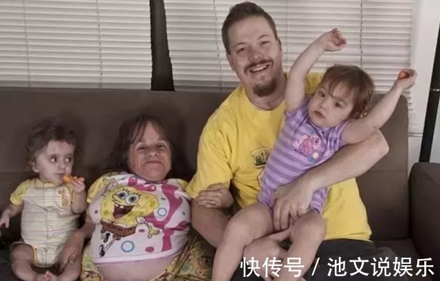 斯泰茜·赫勒尔德|“袖珍女孩”意外收获1米9丈夫,生下2个混血儿,如今又怀上了