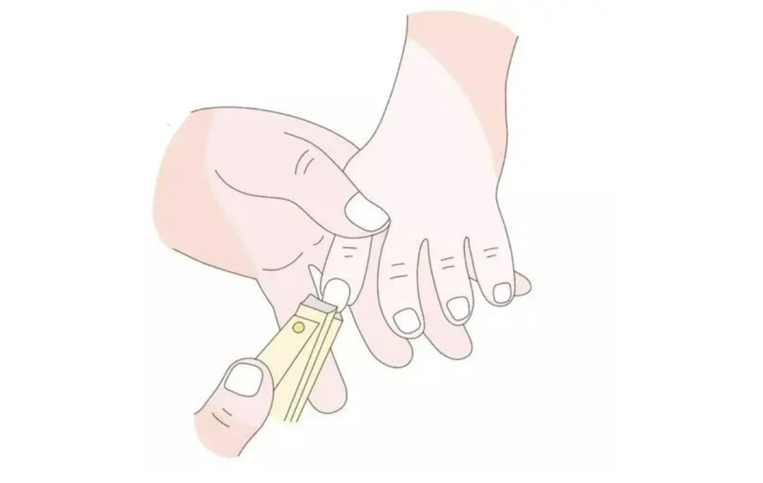 糖尿病患者|糖尿病人剪指甲需特别注意 指甲剪太短极易引发感染