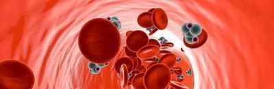 三高|高血脂的原因找到了,做好4个方面,血脂降下,三高悄悄溜走