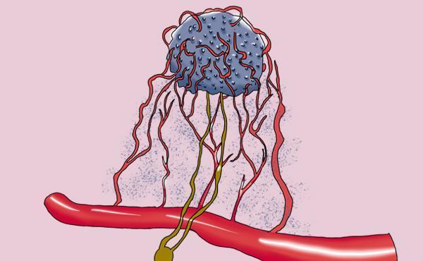 癌症患者|07年查出患癌,与癌细胞和平共处14年,他分享的感悟,值得深思