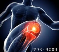 护膝操|家里老人膝盖疼痛骨科专家教你护理，这套护膝操，下楼不再疼痛