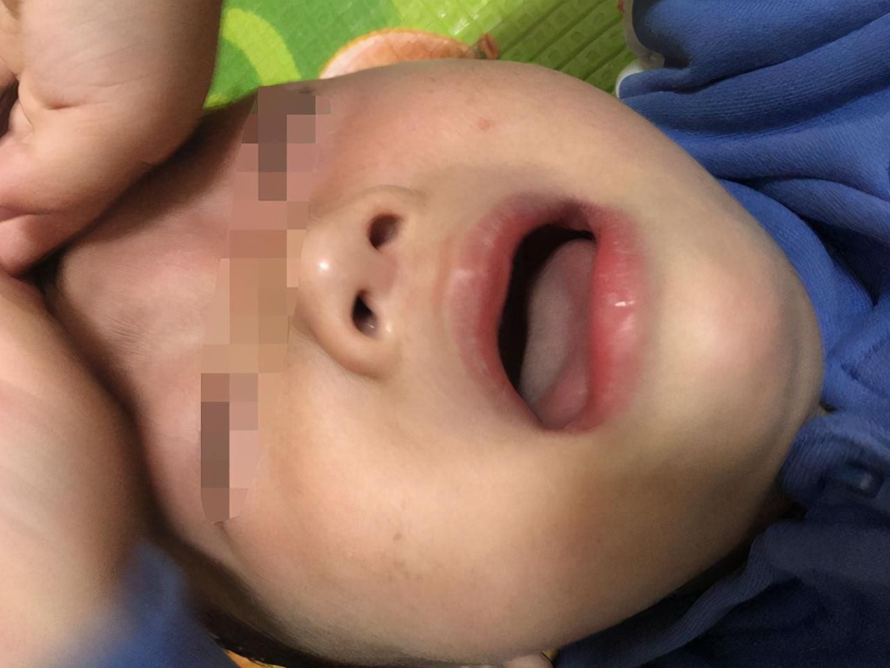 鼻涕|从鼻涕看健康状况：孩子出现这4种症状，家长应及时带他去医院