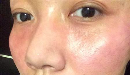 你的护肤方式上黑名单了吗辟谣10个火爆全网的烂脸护肤伪科学