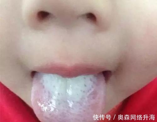 舌苔变得“肥厚”,是暗示身体出了什么问题吗?该如何调理?