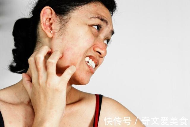 皮炎|湿疹、皮炎,擦什么好得快?常见皮肤病“用药指南”,一看就会