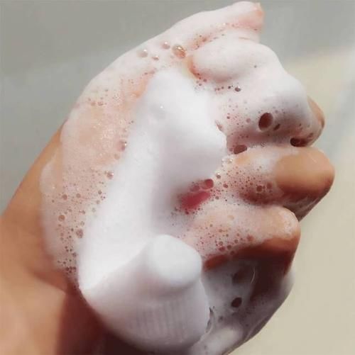 痘痘|3种公认“烂脸”的洗面奶,长期用角质层变薄伤脸,你还敢用吗?