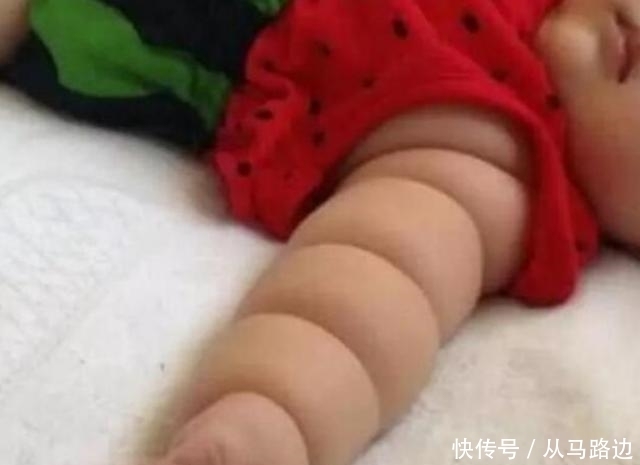 米其林|孙子长得像“米其林”很可爱,奶奶得意炫耀,医生:并非好事