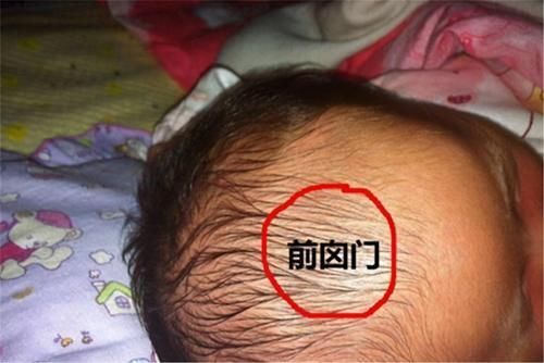 大脑|宝宝卤门护理有多重要?如果出现这些情况,要尽快带娃去医院